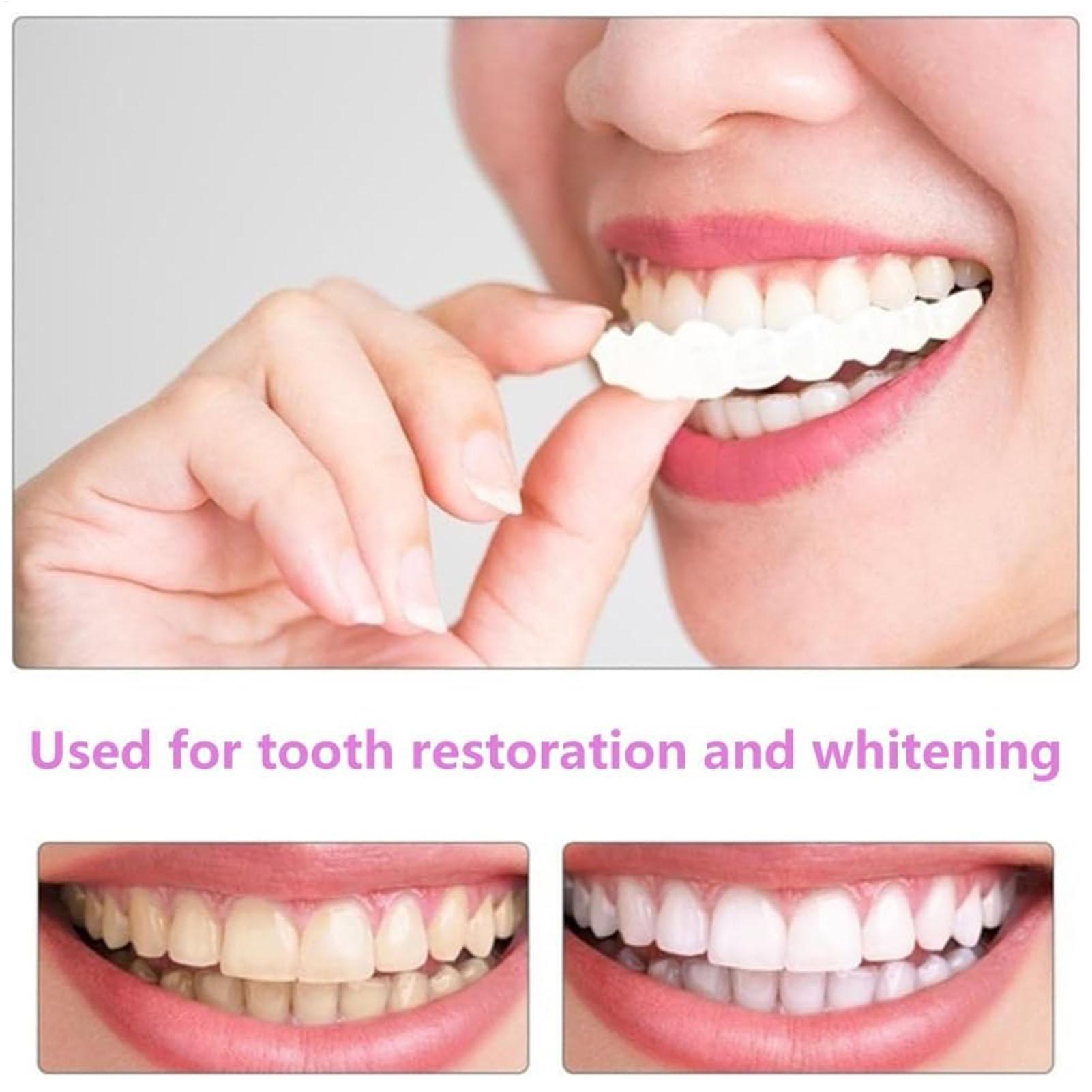 Teeth Whitening Fast - 1 para długotrwałych nakładek na zęby,