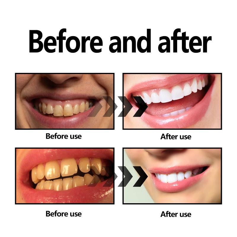 Proszek do wybielania zębów z  – Teeth Whitening Charcoal Powder recenzja i cena
