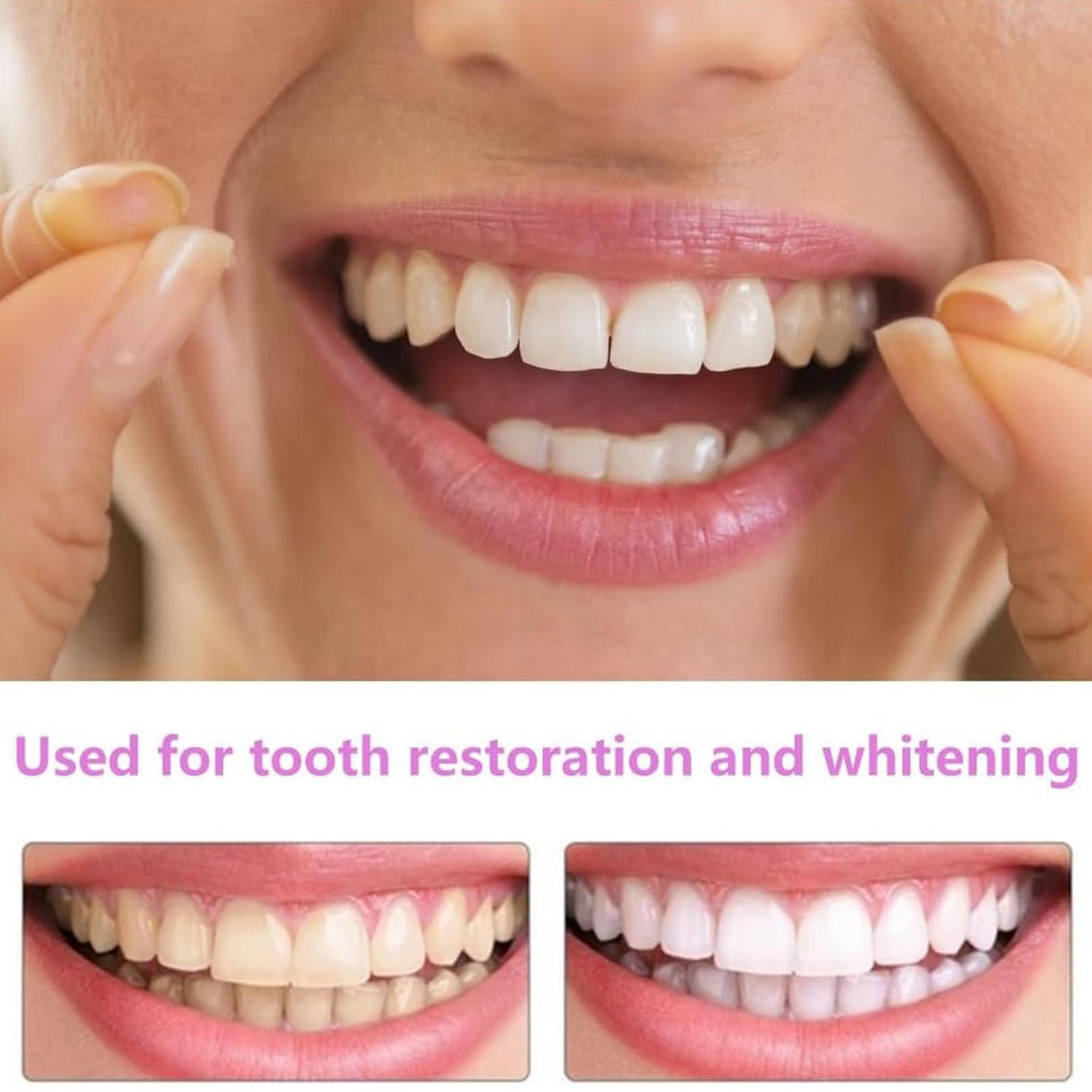 1 para długotrwałych nakładek  – Teeth Whitening Fast recenzja i cena
