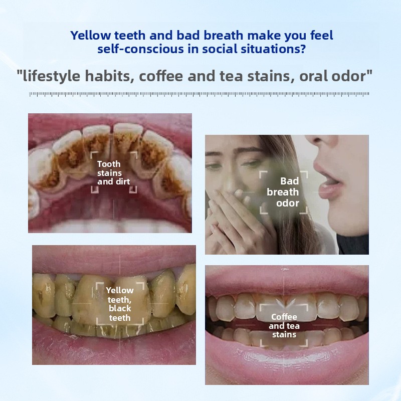 Enzymatyczny proszek do zębów  – Teeth Whitening Enzymes recenzja i cena
