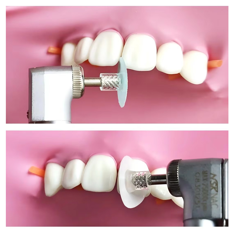 40 szt. Dyski polerskie dentys – Teeth Whitening Home recenzja i cena