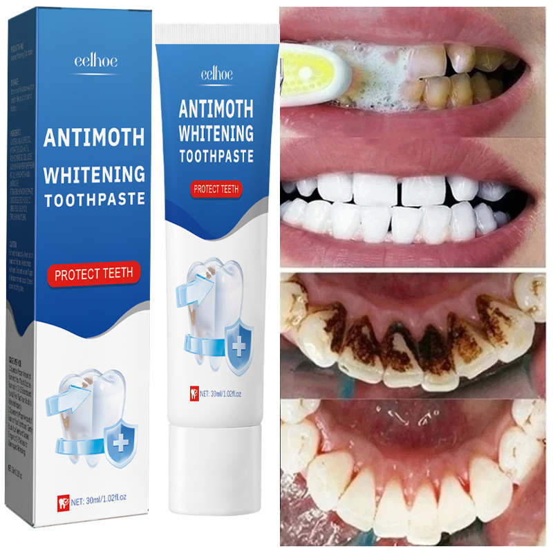 Szybkie usuwanie plam z dymu P – Teeth Whitening Fast recenzja i cena