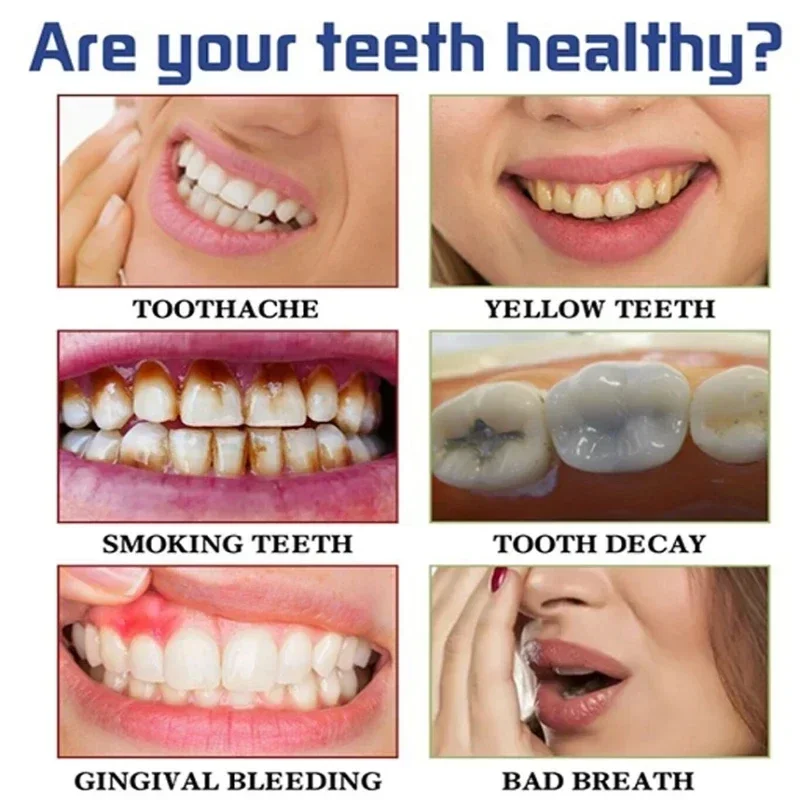 Szybkie usuwanie plam z dymu P – Teeth Whitening Fast recenzja i cena