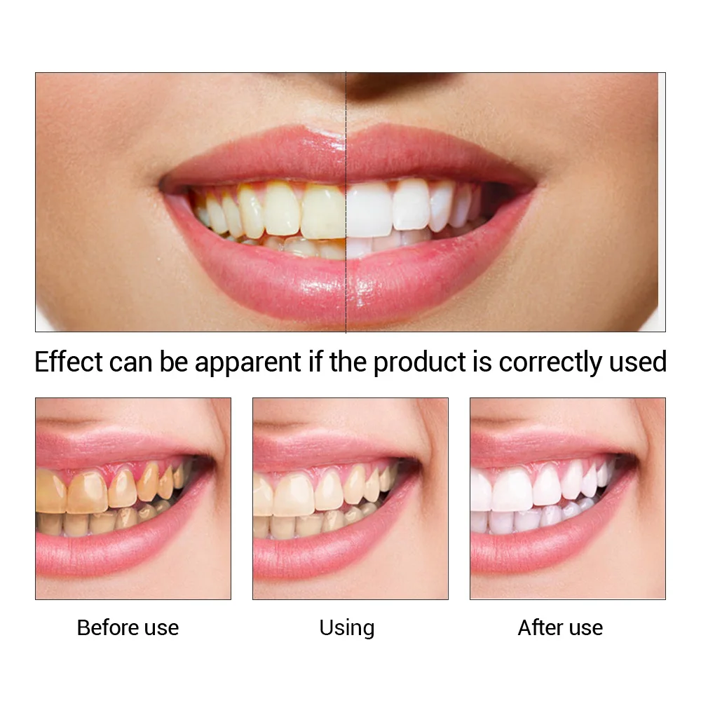 FTEENPLY esencja do wybielania – Teeth Whitening App recenzja i cena