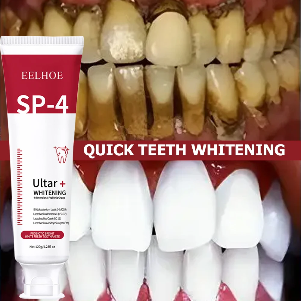 5 szt. Sp-4 120g probiotycznej – Teeth Whitening Enzymes recenzja i cena