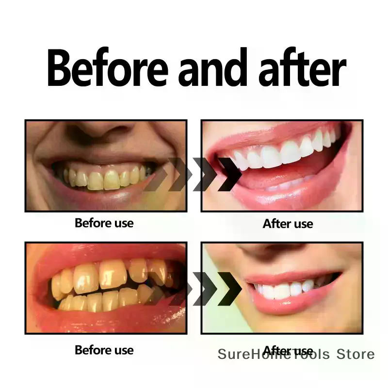 Proszek z węgla bambusowego do – Teeth Whitening Charcoal Powder recenzja i cena