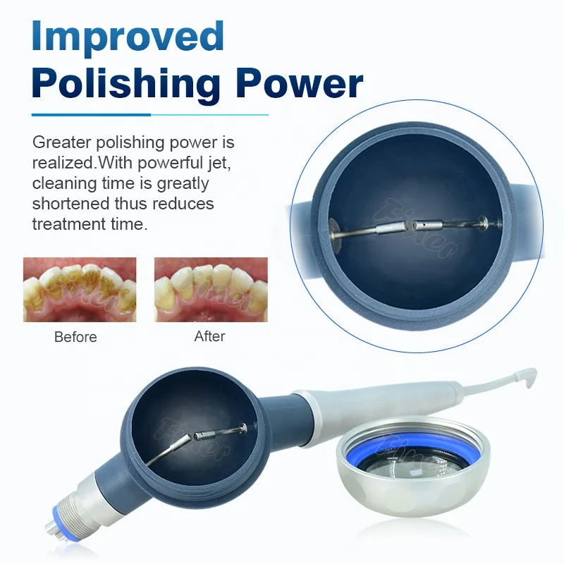 Prophy Mate System do czyszcze – Teeth Whitening Fast recenzja i cena