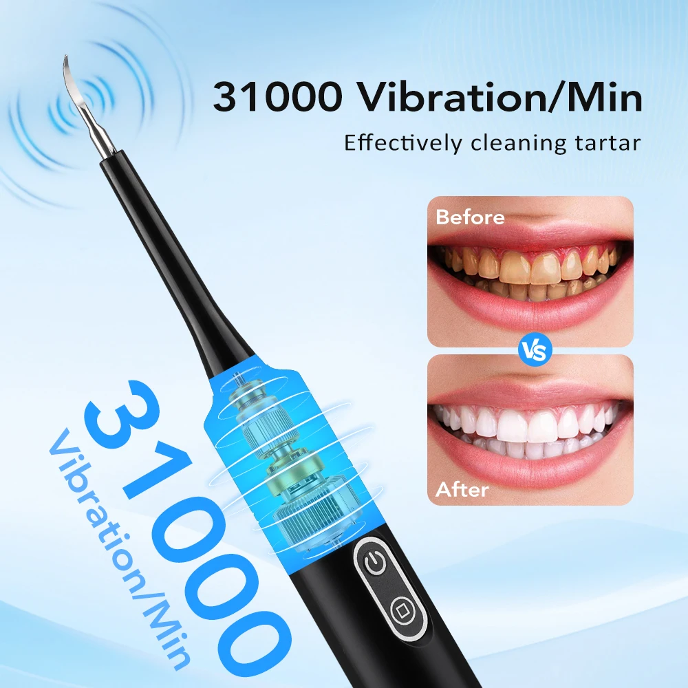 Elektryczny soniczny skaler de – Teeth Whitening Home recenzja i cena